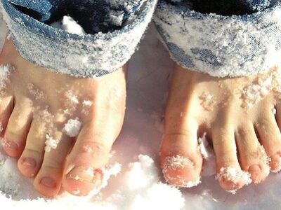 Foot Conditions in Winter